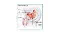 Sign langugae video about prostate cancer