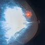 Unhealthy lifestyles linked to UK cancer rates
