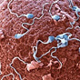 Fertility techniques for genetic disease examined