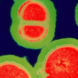 WHO warns of drug resistant superbugs