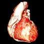 Stem cells may aid heart repair